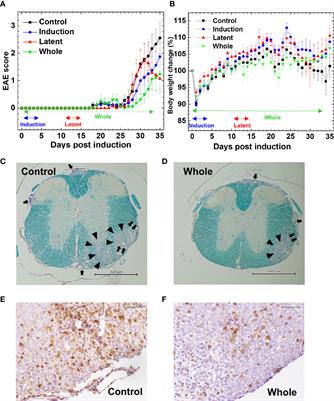 Curcumin β-D-Glucuronide Modulates an Autoimmune Model of Multiple Sclerosis with Altered Gut Microbiota in the Ileum and Feces